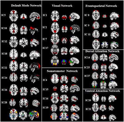 Abnormal large-scale resting-state functional networks in anti-N-methyl-D-aspartate receptor encephalitis